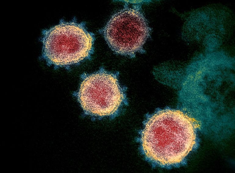 Изображение коронавируса SARS-CoV-2, полученное с помощью электронного микроскопа